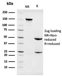 SDS-PAGE analysis of Anti-Nucleophosmin Antibody [NPM1/3286] under non-reduced and reduced conditions; showing intact IgG and intact heavy and light chains, respectively. SDS-PAGE analysis confirms the integrity and purity of the antibody