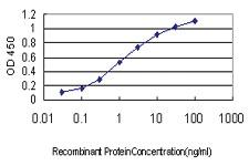 Anti-BTF3 Mouse Monoclonal Antibody [clone: 3C4-2E11]