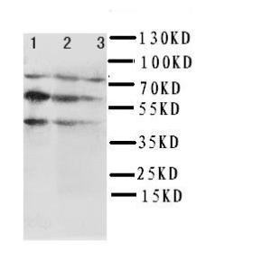 Anti-Beclin 1 Rabbit Polyclonal Antibody