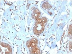 Immunohistochemical analysis of formalin-fixed, paraffin-embedded human breast using Anti-LRG1 Antibody [LRG1/4882] at 2 µg/ml in PBS for 30 minutes at room temperature