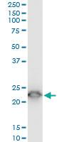 Anti-TPT1 Mouse Monoclonal Antibody [clone: 2C4]