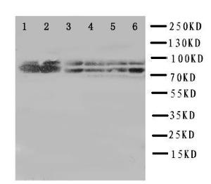 Anti-B Raf Rabbit Polyclonal Antibody