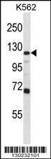 Anti-GRIA4 Rabbit Polyclonal Antibody (Biotin)