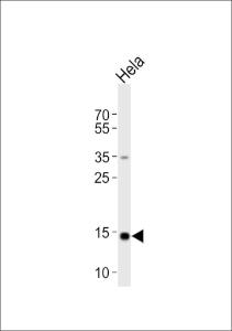 Anti-FIS1 Rabbit Polyclonal Antibody