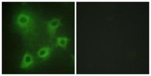 Immunofluorescence analysis of COS7 cells using Anti-SYK Antibody. The right hand panel represents a negative control, where the antibody was pre-incubated with the immunising peptide