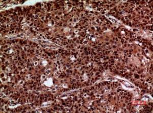 Immunohistochemical analysis of paraffin-embedded human lung using Anti-IFNGR1 Antibody