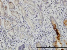 Anti-NUP133 Mouse Monoclonal Antibody [clone: 3E8]