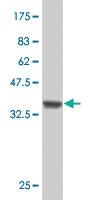 Anti-TCTE3 Mouse Polyclonal Antibody