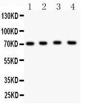 Anti-KCND1/Kv4.1 Polyclonal Antibody