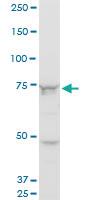 Anti-SETX Mouse Monoclonal Antibody [clone: 2A9]