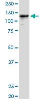 Anti-GTF2I Polyclonal Antibody Pair