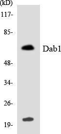 Western blot analysis of the lysates from RAW264.7 cells using Anti-Dab1 Antibody