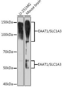 Western blot analysis of extracts of various cell lines, using Anti-EAAT1 Antibody [ARC1714] (A306133) at 1:1,000 dilution The secondary antibody was Goat Anti-Rabbit IgG H&L Antibody (HRP) at 1:10,000 dilution Lysates/proteins were present at 25 µg per lane