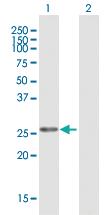 Anti-MFAP2 Mouse Polyclonal Antibody