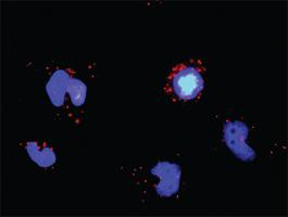 Anti-TRAF5 + TRAF3 Antibody Pair