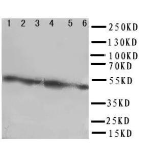 Anti-Coxsackie Adenovirus Receptor Rabbit Polyclonal Antibody