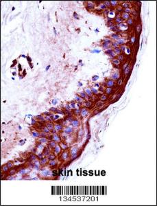 Anti-KLK9 Rabbit Polyclonal Antibody (FITC (Fluorescein Isothiocyanate))