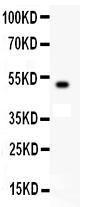 Anti-KIT/SCFR Polyclonal Antibody