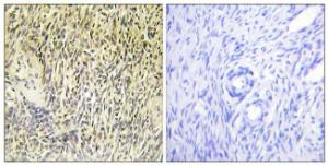 Immunohistochemical analysis of paraffin-embedded human ovary tissue using Anti-SYK Antibody. The right hand panel represents a negative control, where the antibody was pre-incubated with the immunising peptide