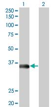 Anti-MSI2 Mouse Monoclonal Antibody [clone: 3C6]