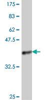 Anti-PSMB3 Mouse Polyclonal Antibody