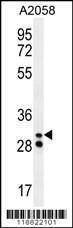 Anti-Neutrophil elastase Rabbit Polyclonal Antibody (APC (Allophycocyanin))