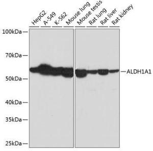 Western blot analysis of extracts of various cell lines, using Anti-ALDH1A1 Antibody [ARC52440] (A309053) at 1:1000 dilution