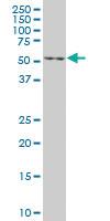 Anti-EN1 Mouse Monoclonal Antibody [clone: 3G9]