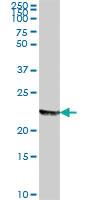 Anti-MFAP2 Mouse Polyclonal Antibody