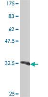 Anti-ING5 Mouse Polyclonal Antibody