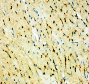 Anti-Fatty Acid Binding Protein 5 Rabbit Polyclonal Antibody