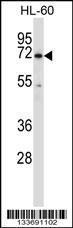 Anti-BTK Rabbit Polyclonal Antibody (HRP (Horseradish Peroxidase))