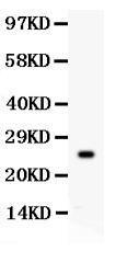 Anti-Kallikrein 4 Polyclonal Antibody