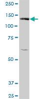 Anti-BUB1 Mouse Polyclonal Antibody