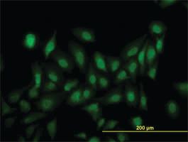 Anti-LRRFIP1 Mouse Monoclonal Antibody [clone: 3E1]