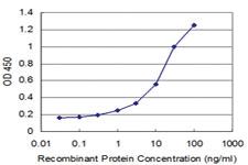 Anti-MSI2 Mouse Monoclonal Antibody [clone: 3C6]