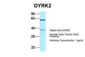 Anti-DYRK2 Rabbit Polyclonal Antibody