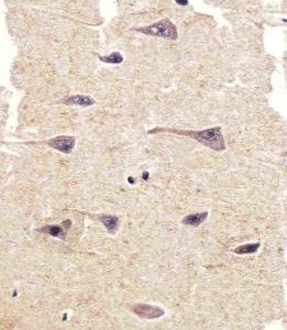 Anti-PTK2B Rabbit Polyclonal Antibody