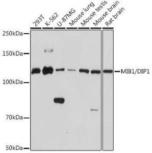 Western blot analysis of extracts of various cell lines, using Anti-Mib1 / Mindbomb Antibody [ARC1958] (A307813) at 1:1,000 dilution. The secondary antibody was Goat Anti-Rabbit IgG H&L Antibody (HRP) at 1:10,000 dilution.