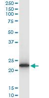 Anti-TPT1 Mouse Monoclonal Antibody [clone: 2C4]