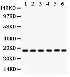 Anti-CIB1 Rabbit Polyclonal Antibody