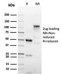 SDS-PAGE analysis of Anti-His Tag Antibody [6HIS/6402R] under non-reduced and reduced conditions; showing intact IgG and intact heavy and light chains, respectively. SDS-PAGE analysis confirms the integrity and purity of the antibody.