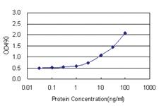 Anti-AK1 Antibody Pair