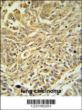 Anti-GSTK1 Rabbit Polyclonal Antibody (FITC (Fluorescein Isothiocyanate))