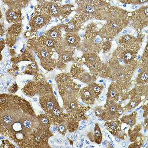 Immunohistochemistry analysis of paraffin-embedded human liver using Anti-NNMT Antibody (A92881) at a dilution of 1:100 (40x lens). Perform high pressure antigen retrieval with 10 mM citrate buffer pH 6.0 before commencing with IHC staining protocol.