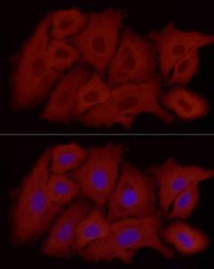 Immunofluorescence analysis of A-549 using Anti-ALDH1A1 Antibody [ARC52440] (A309053) at a dilution of 1:800 (40x lens). DAPI was used to stain the cell nuclei (blue)