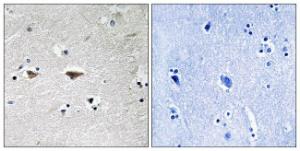 Anti-SRC Family Rabbit Polyclonal Antibody