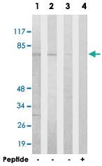 Anti-HKR1 Rabbit Polyclonal Antibody