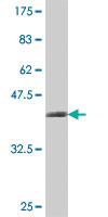 Anti-DIP2A Mouse Polyclonal Antibody