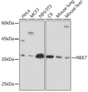 Western blot analysis of extracts of various cell lines, using Anti-NEK7 Antibody [ARC2342] (A307814) at 1:1000 dilution. The secondary Antibody was Goat Anti-Rabbit IgG H&L Antibody (HRP) at 1:10000 dilution. Lysates/proteins were present at 25 µg per lane